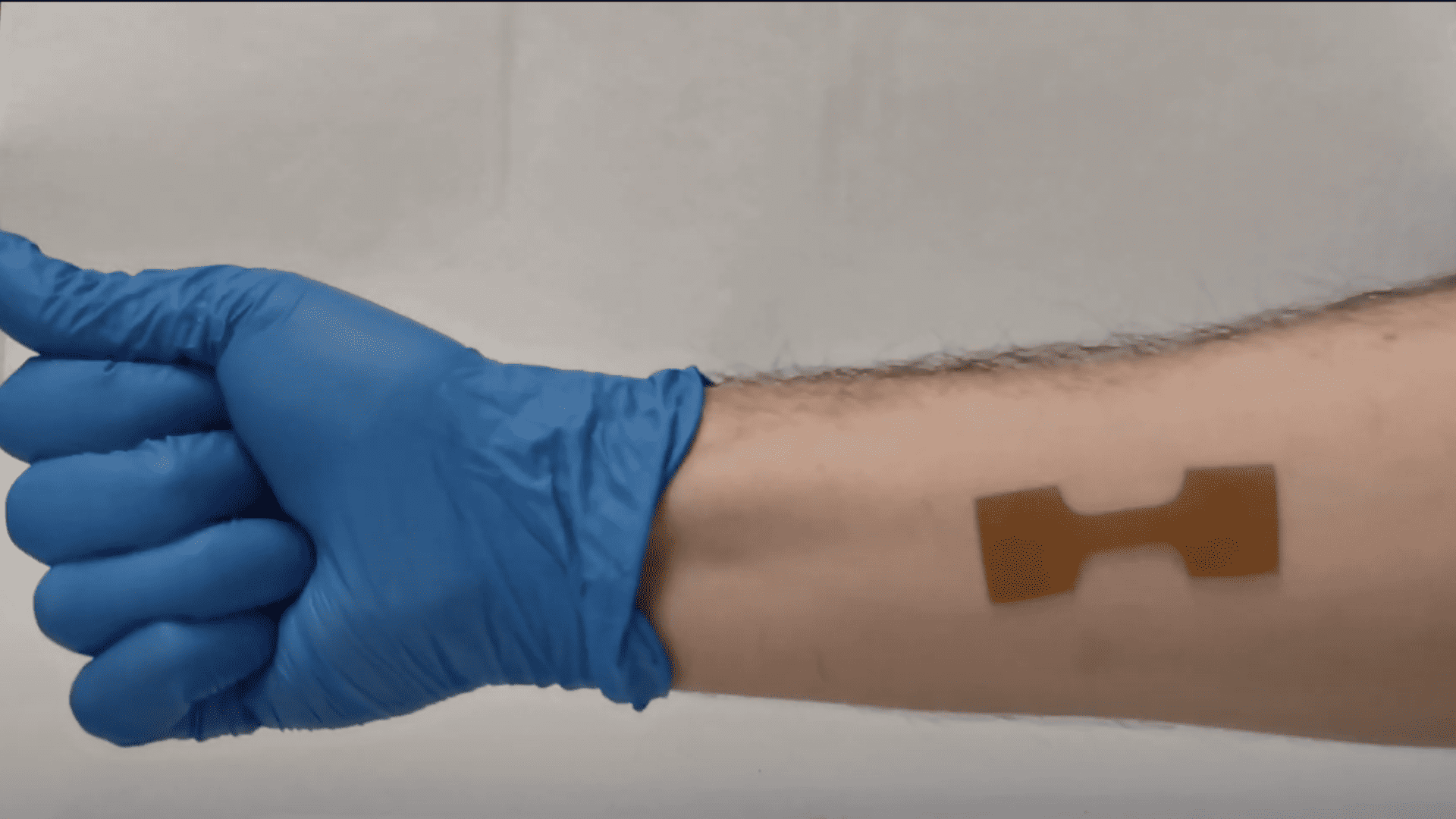 Wellcare World | health | Wellcare World University Waterloo University Waterloo 3D Printing for Burn & Cancer Patients